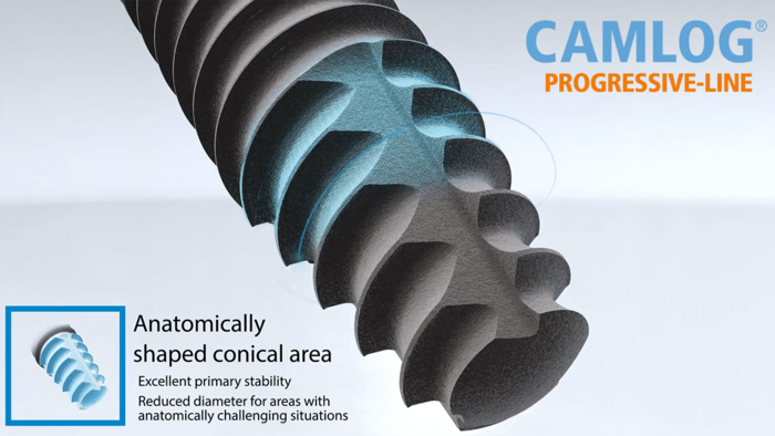 CAMLOG PROGRESSIVE-LINE