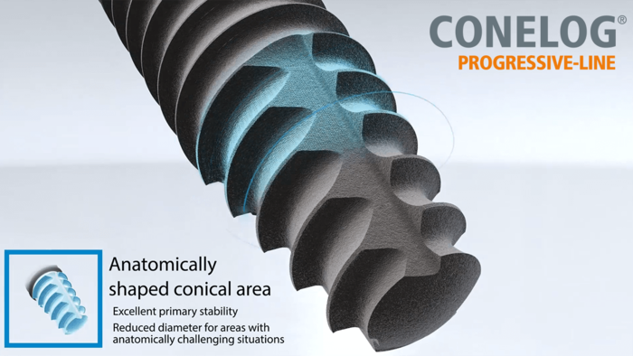 CONELOG PROGRESSIVE-LINE