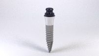 Mini Implant