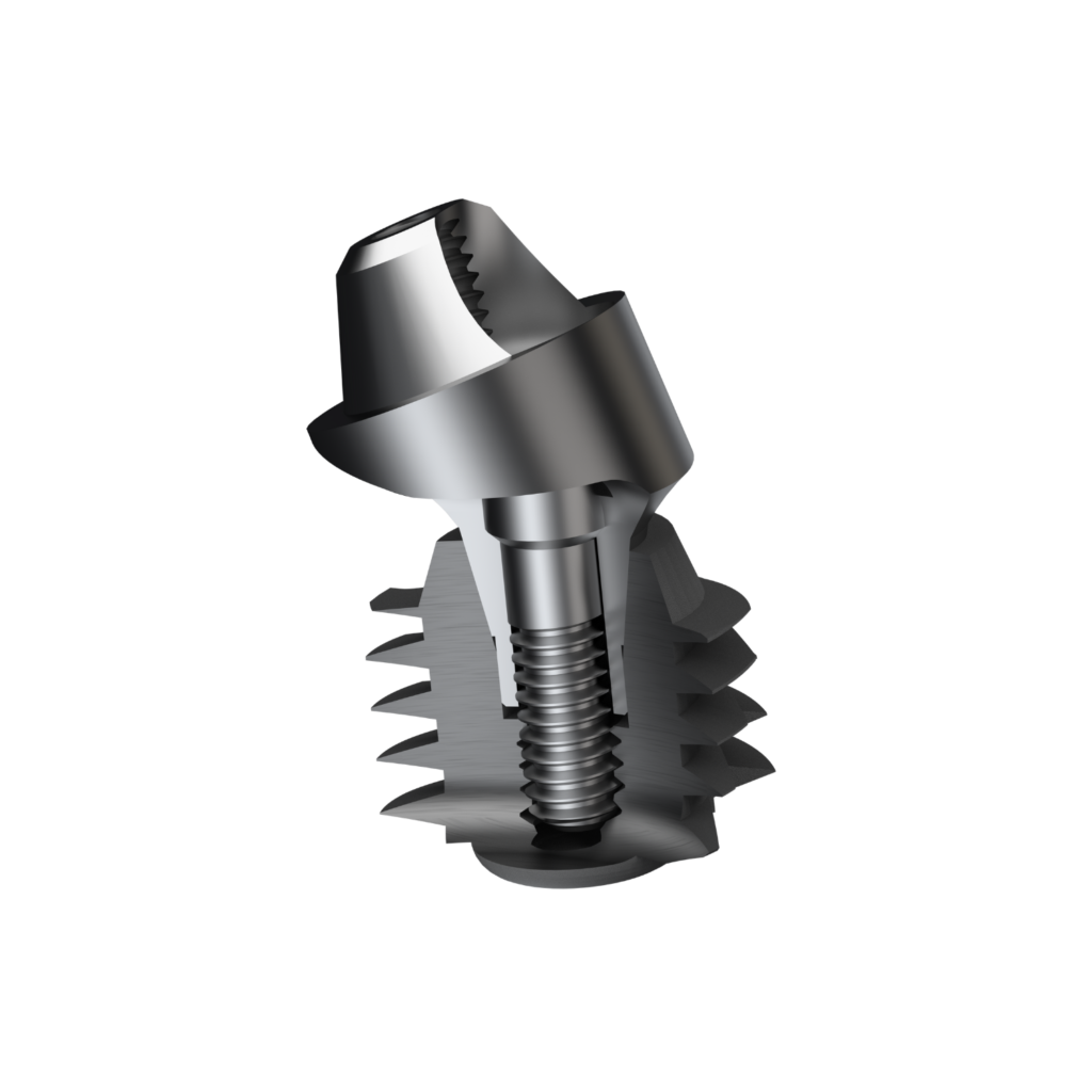 Short Implant